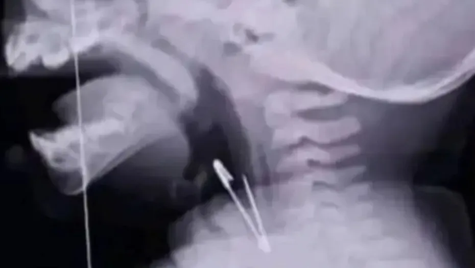 IMG_20240926_164603_(930_x_525_píxel)