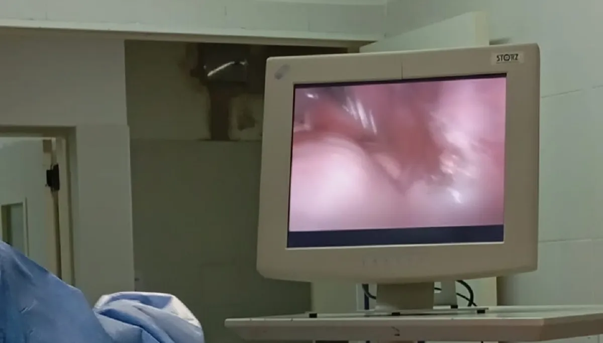 Monitor