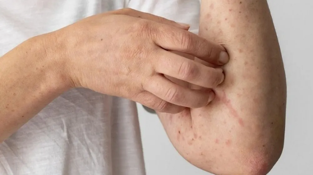 9171ba47ee5639d578bf33b4d285ed02_XL