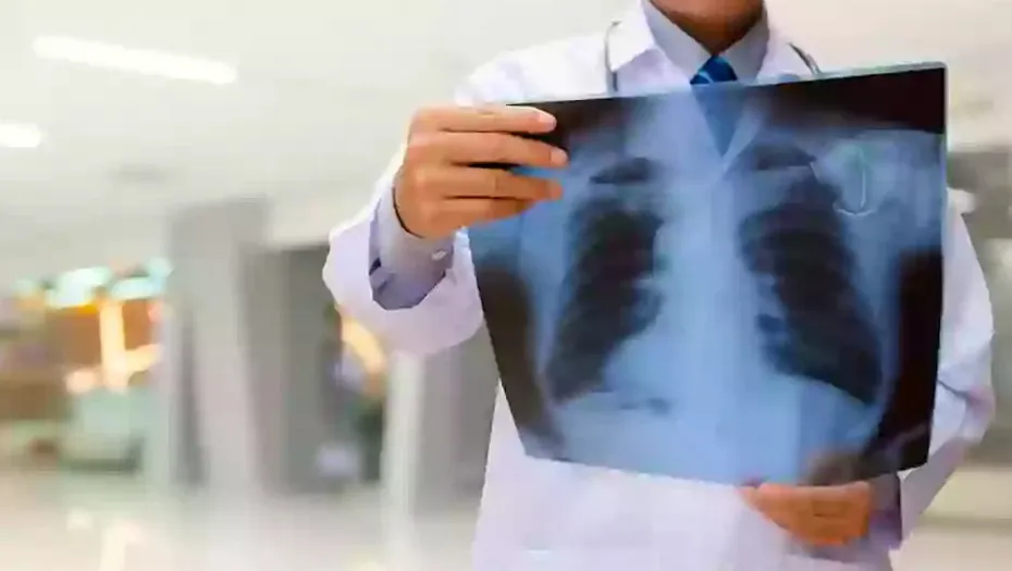 IMG_20241119_181804_(930_x_525_píxel)