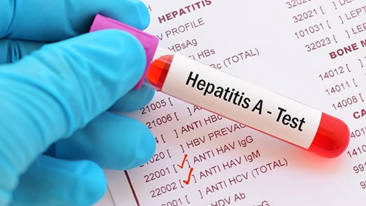 Hepatitis