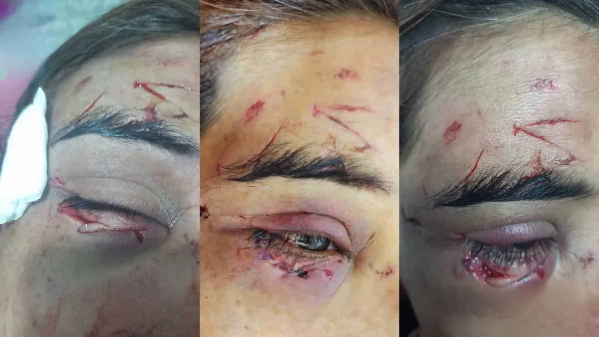 Violencia en El Jardón