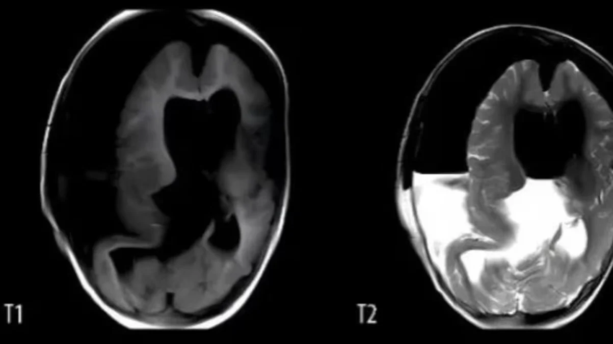 radiografia