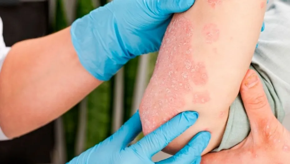 IMG_20240812_195641_(930_x_525_píxel)