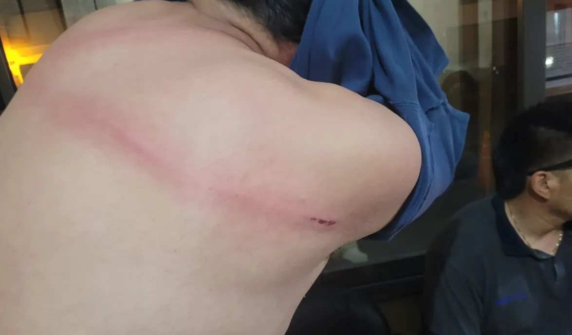 agresión inspector municipal