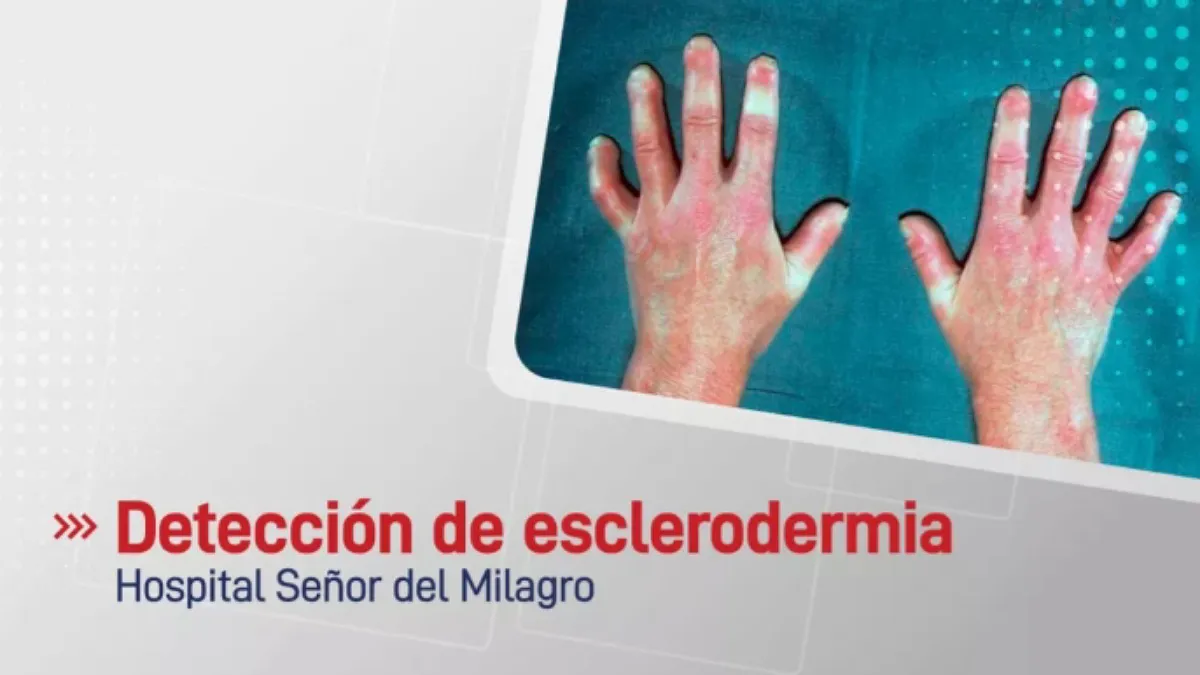 IMG_20250623_162315_(1200_x_675_píxel)