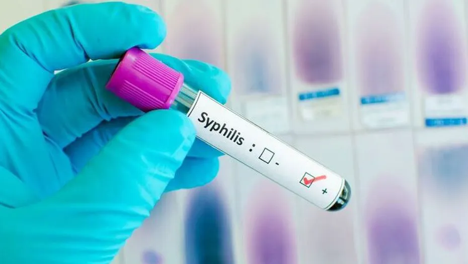 IMG_20240904_161457_(930_x_525_píxel)