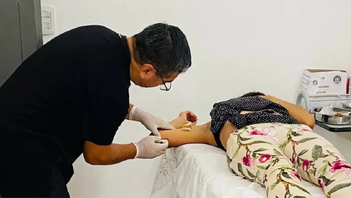 Implantes subdermicos