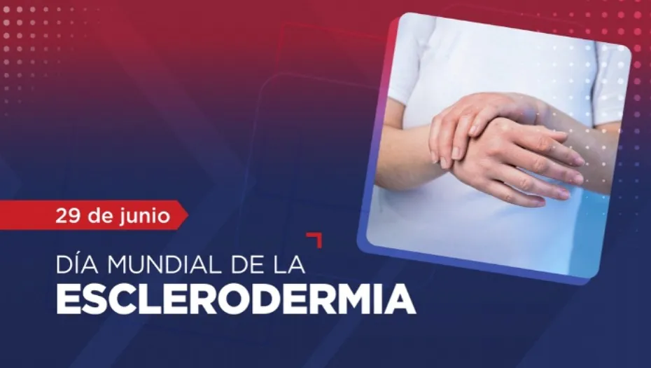 IMG_20240627_171923_(930_x_525_píxel)