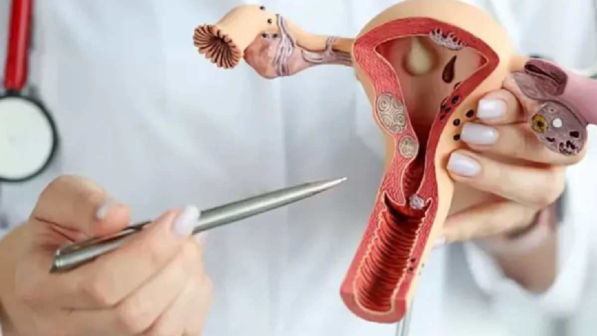 Cancer ed cuello uterino