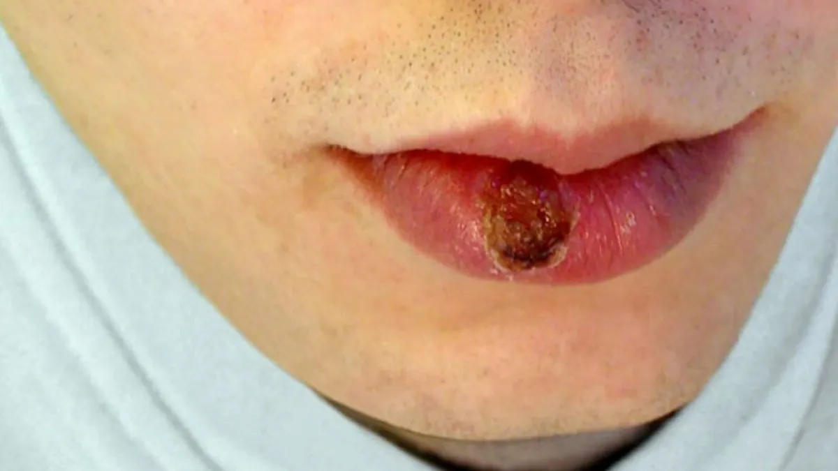 IMG_20251112_183813_(1200_x_675_píxel)