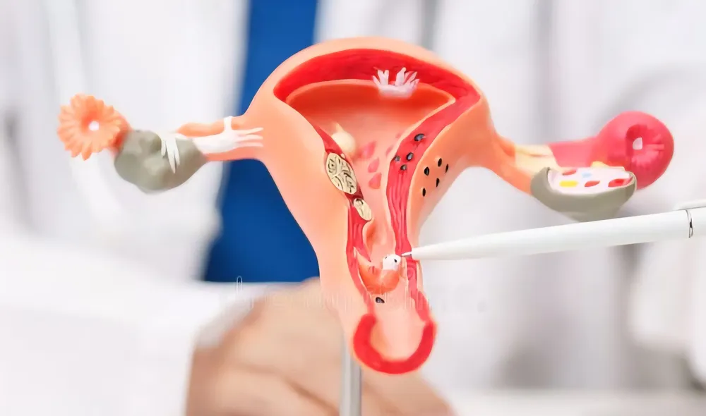 doctor-uterus-ovaries-anatomy-model-ovarian-cervical-cancer-cervix-disorder-endometriosis-hysterectomy-uterine-doctor-439860833