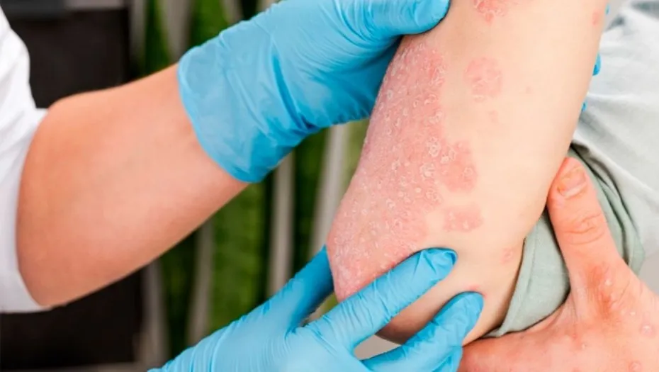 IMG_20240823_185316_(930_x_525_píxel)